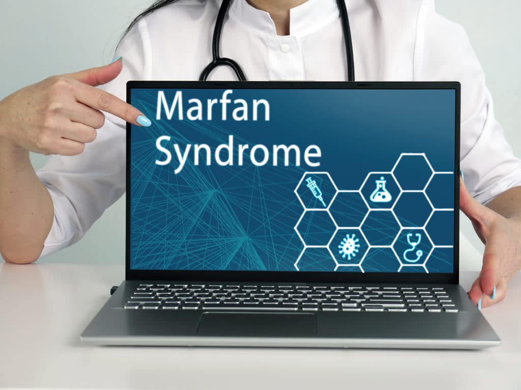Marfan Syndrome phrase on the screen. Oncologist use cell technologies at office.