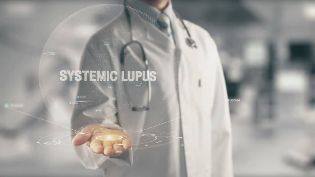 Doctor holding in hand Systemic Lupus