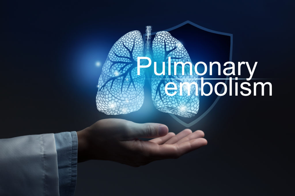  Pulmonary Embolism on blue background with large