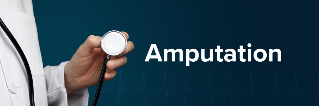 disability benefits for Amputation. Doctor in smock holds stethoscope. The word Amputation