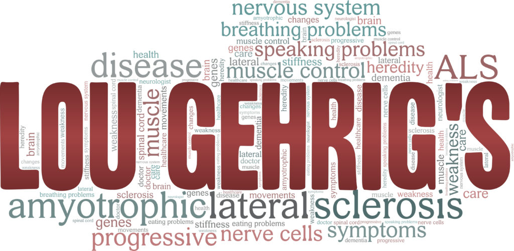 Amyotrophic lateral sclerosis - ALS - Lou Gehrig's disease vector