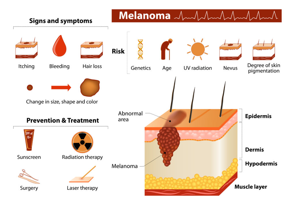 skin cancer symptoms pictures and signs