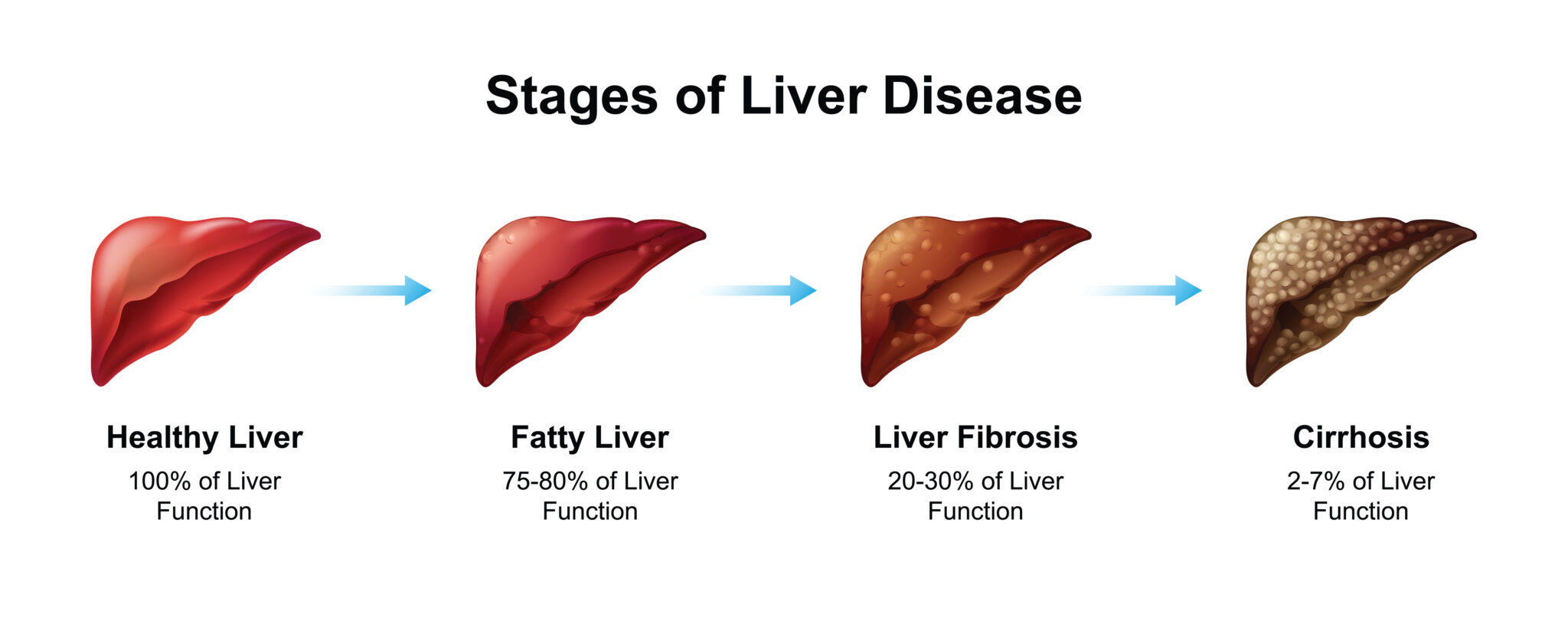 CHRONIC LIVER DISEASE DISABILITY Cannon Disability Law