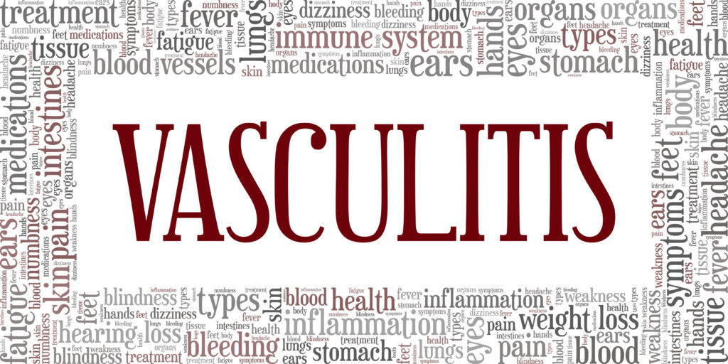 Systemic Vasculitis word cloud conceptual design isolated on white background.