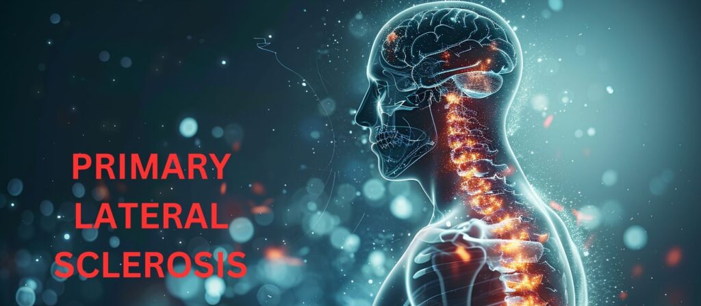 PRIMARY LATERAL SCLEROSIS