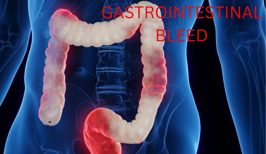 man with gastrointestinal bleed showing intestine