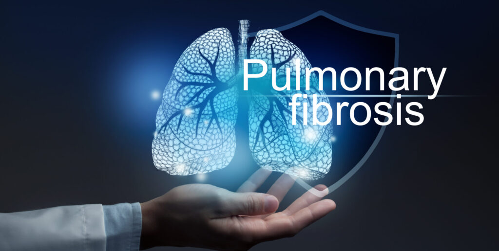 Pulmonary fibrosis on blue background