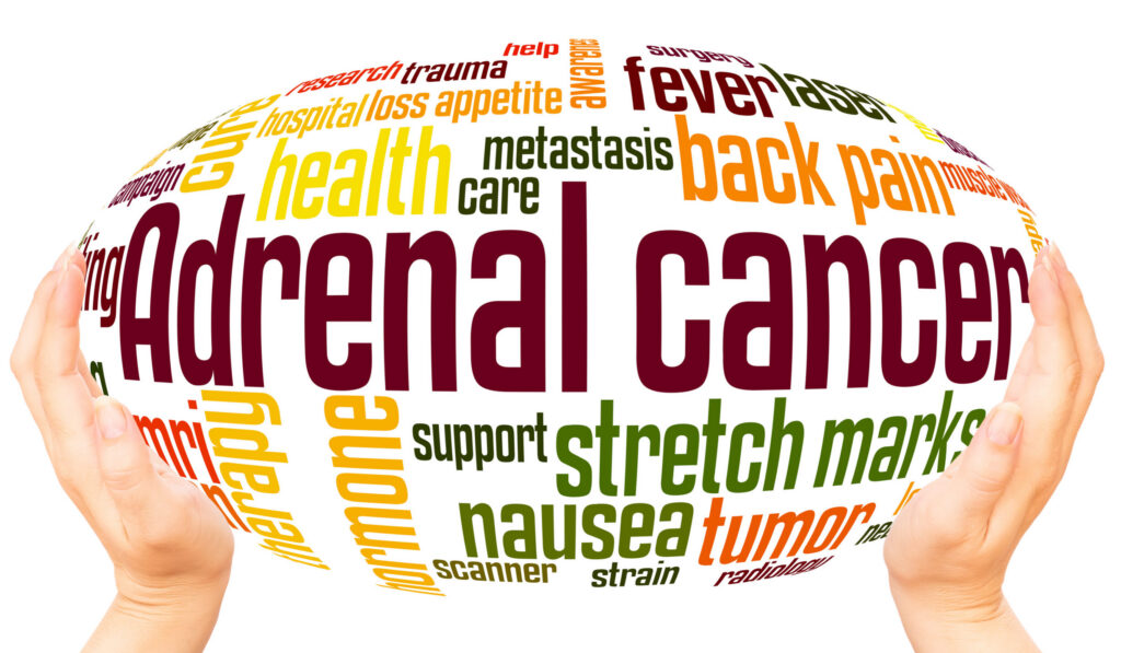 Adrenal cancer word hand sphere cloud concept